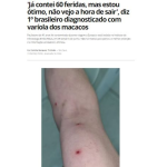 《ブラジル》サル痘感染者が３人に＝サンパウロ州で２人目＝リオ・グランデ・ド・スルでも