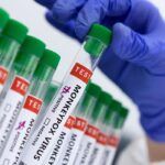 《ブラジル》サル痘感染確定者が８人に＝最初の患者に退院許可