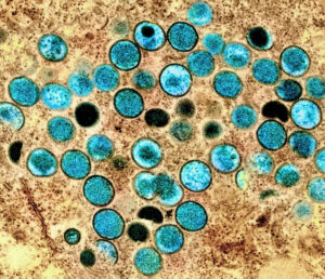 サル痘ウイルス顕微鏡写真（NIAID-NIH）