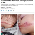 《サンパウロ州》双子の赤ちゃんが大怪我＝車が路上のワイヤー跳ね上げる