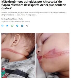 幼子の顔に残る傷跡（２３日付Ｇ１サイトの記事の一部）