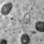 オズワルド・クルス財団がとらえた細胞分裂中のサル痘ウイルス（Debora F. Barreto-Vieira/IOC/Fiocruz）