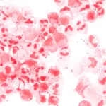 髄膜炎を引き起こす細菌（Wikimedia）