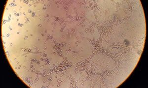 サル痘ウイルス（Debora F. Barreto-Vieira/IOC/Fiocruz）