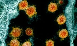 新型コロナウイルス（NIAID）