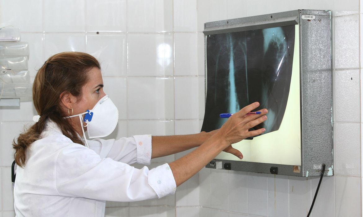 レントゲン写真を確認する医療関係者（Agencia Bahia）