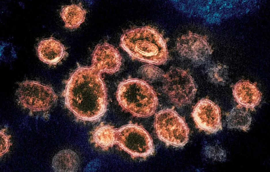 新型コロナウイルスの顕微鏡写真（NIAID-RML via AP）