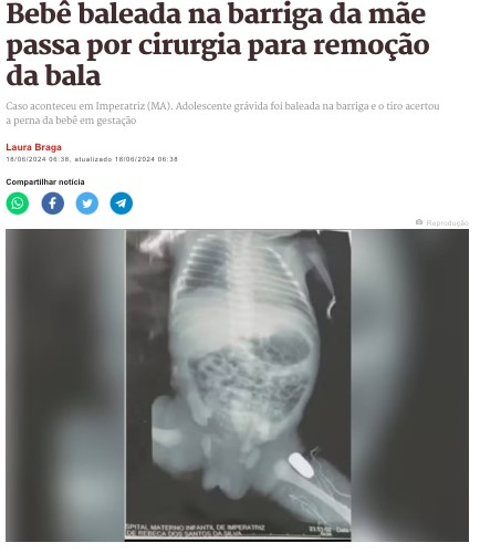 赤ちゃんは左大腿部に被弾した（16日付メトロポレ・サイトの記事の一部）