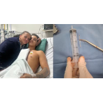 胸部に釘が刺さり緊急手術を受けたエデルソンさん（Foto: Hospital Dom Joaquim/ Divulgação）