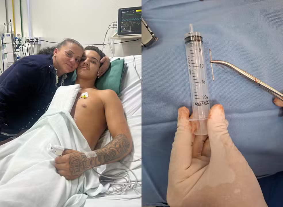 胸部に釘が刺さり緊急手術を受けたエデルソンさん（Foto: Hospital Dom Joaquim/ Divulgação）